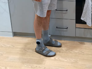 Smart socks - helping revolutionise patient care